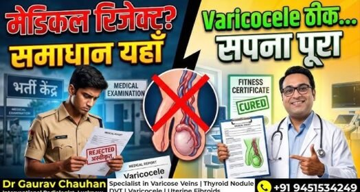 varicocele treatment