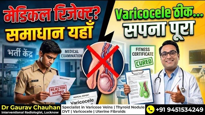 varicocele treatment